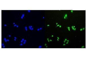 IF analysis of HDGF using anti-HDGF antibody (ABIN4886613). (HDGF antibody  (C-Term))