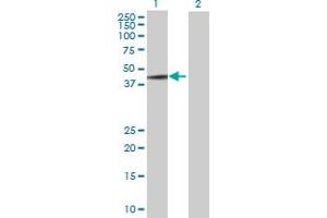 Western Blot analysis of MAGEA3 expression in transfected 293T cell line by MAGEA3 MaxPab polyclonal antibody. (MAGEA3 antibody  (AA 1-314))