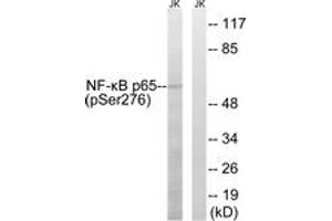 Western blot analysis of extracts from Jurkat cells, using NF-kappaB p65 (Phospho-Ser276) Antibody. (NF-kB p65 antibody  (pSer276))