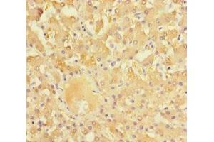 Immunohistochemistry of paraffin-embedded human liver tissue using ABIN7161898 at dilution of 1:100