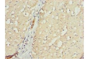 Immunohistochemistry of paraffin-embedded human small intestine tissue using ABIN7161725 at dilution of 1:100 (NLE1 antibody  (AA 206-485))