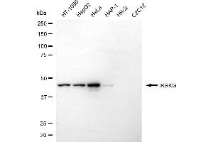 Western blotting analysis using IKBKG antibody (ABIN7799037).
