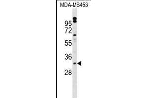 VENTX Antibody (Center) (ABIN1539682 and ABIN2849571) western blot analysis in MDA-M cell line lysates (35 μg/lane).