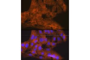 Immunofluorescence analysis of C6 cells using TBK1/NAK Rabbit mAb (ABIN7270723) at dilution of 1:100 (40x lens). (TBK1 antibody)