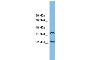 WB Suggested Anti-C6orf134 Antibody Titration: 0. (Chromosome 6 Open Reading Frame 134 (C6orf134) (N-Term) antibody)