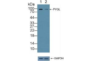 Western Blotting (WB) image for anti-phosphorylase, Glycogen, Liver (PYGL) (AA 370-538) antibody (ABIN7438019)