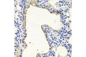 Immunohistochemistry of paraffin-embedded mouse lung using PKN1 antibody (ABIN6003498) at dilution of 1/100 (40x lens). (PKN1 antibody)