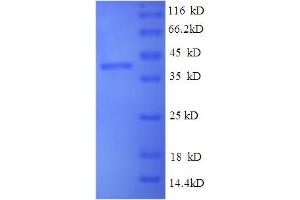 WNT2 Protein (AA 26-360) (His tag)