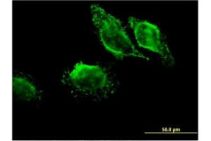 Immunofluorescence of monoclonal antibody to MAPRE3 on HeLa cell. (MAPRE3 antibody  (AA 125-218))