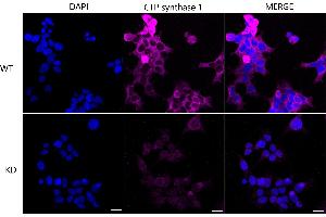 Immunocytochemical staining of 293T cells using CTP synthase 1 antibody (ABIN7798174), 1:1,000), Top panel: wild-type (WT), Bottom panal: CTP synthase 1 shRNA knockdown (KD). (Recombinant CTP Synthase antibody)