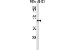 Western Blotting (WB) image for anti-Sirtuin 3 (SIRT3) antibody (ABIN2998084)