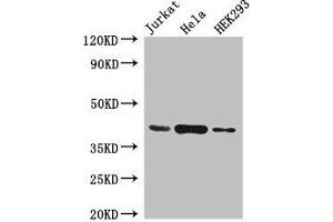 Western Blot Positive WB detected in: Jurkat whole cell lysate, Hela whole cell lysate, HEK293 whole cell lysate All lanes: HLA-C antibody at 4 μg/mL Secondary Goat polyclonal to rabbit IgG at 1/50000 dilution Predicted band size: 41 kDa Observed band size: 41 kDa