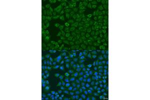 Immunofluorescence analysis of U2OS cells using FMO5 antibody (ABIN2736763) at dilution of 1:100. (FMO5 antibody)