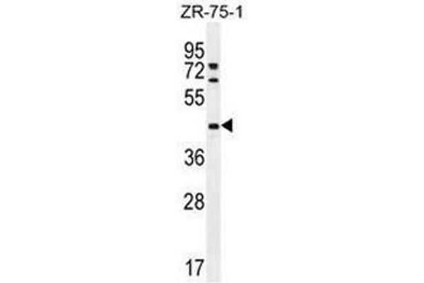 METTL2 antibody  (C-Term)