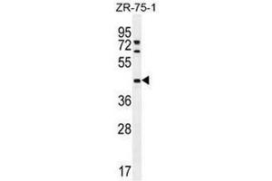 METTL2 Antibody (C-term) western blot analysis in ZR-75-1 cell line lysates (35µg/lane). (METTL2 antibody  (C-Term))