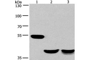 Western Blot analysis of Mouse brain and Human fetal muscle tissue, Mouse heart tissue using CABLES1 Polyclonal Antibody at dilution of 1:650 (CABLES1 antibody)
