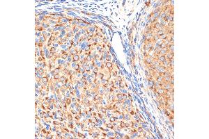 Immunohistochemistry of paraffin-embedded rat ovary using G1 Rabbit mAb (ABIN7265446) at dilution of 1:100 (40x lens). (gamma 1 Adaptin antibody)