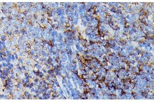 Immunohistochemistry of paraffin-embedded Rat spleen using HLA-B Polyclonal Antibody at dilution of 1:100 (40x lens). (HLA-B antibody)