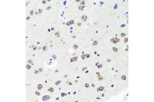 Immunohistochemistry of paraffin-embedded mouse brain using DLG1 antibody at dilution of 1:100 (x40 lens). (DLG1 antibody)