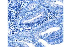 Immunohistochemistry (IHC) image for anti-Cullin 4A (CUL4A) antibody (ABIN1872121) (Cullin 4A antibody)