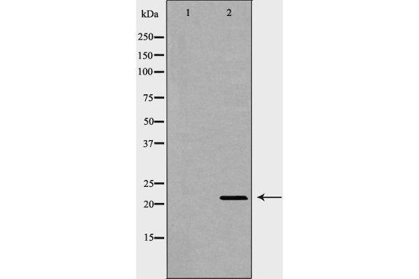 Syndecan 2 antibody  (C-Term)