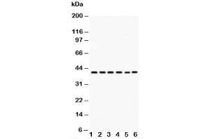 Western blot testing of CXCR2 antibody and Lane 1:  rat spleen;  2: rat kidney;  3: rat brain;  4: mouse testis;  5: HEPA;  6: mouse brainat 50ug;  Predicted size: 41KD;  Observed size: 41KD (CXCR2 antibody)