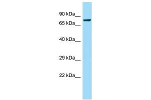 WB Suggested Anti-CAPN8 Antibody Titration: 1. (Calpain 8 antibody  (Middle Region))