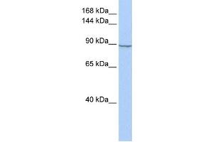 Western Blotting (WB) image for anti-Hexokinase 2 (HK2) antibody (ABIN2459729)
