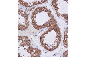 Immunohistochemical analysis of A on paraffin-embedded Human testis tissue. (HDAC6 antibody  (C-Term))