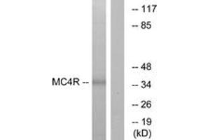 Western blot analysis of extracts from MCF-7 cells, using MC4R Antibody.