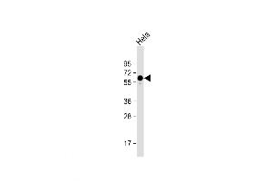 Western Blot at 1:1000 dilution + Hela whole cell lysate Lysates/proteins at 20 ug per lane. (PKM2 antibody  (C-Term))