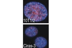 Indirect IF analysis showed that RSKB is localized in the nucleus of parental (10T1/2) and oncogene-transformed (Ciras-3) mouse fibroblasts; DAPI nuclear counterstain. (MSK2 antibody  (AA 322-354))