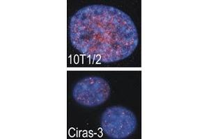 Indirect IF analysis showed that RSKB is localized in the nucleus of parental (10T1/2) and oncogene-transformed (Ciras-3) mouse fibroblasts; DAPI nuclear counterstain.