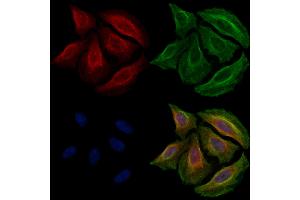 ABIN6256660 and ABIN6267226 staining Hela cells(20 min of 30uM Forskolin treatment) by IF/ICC.