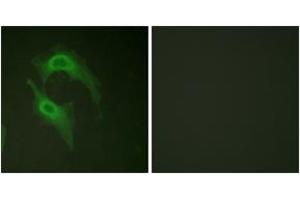 Immunofluorescence analysis of HeLa cells, using CD226/DNAM-1 (Ab-329) Antibody.