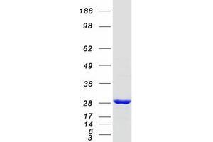 RAB21, Member RAS Oncogene Family (RAB21) protein (Myc-DYKDDDDK Tag)