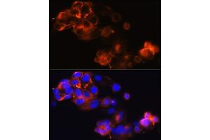 Immunofluorescence analysis of HepG2 cells using Glypican 3 (GPC3) (GPC3) Rabbit mAb (ABIN7267487) at dilution of 1:100 (40x lens). (Glypican 3 antibody)