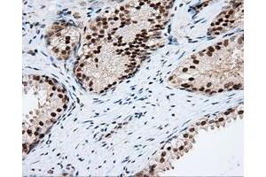 Immunohistochemical staining of paraffin-embedded Kidney tissue using anti-RC201933 mouse monoclonal antibody. (PIM2 antibody)