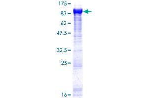 Image no. 1 for Glycyl-tRNA Synthetase (GARS) (AA 1-685) protein (GST tag) (ABIN1354799)