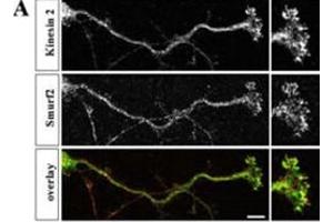 Hippocampal neurons were fixed at stage 3, stained with anti-Smurf2 (red) and anti-Kinesin-2 (green) antibodies, and analyzed by confocal microscopy. (SMURF2 antibody  (C-Term))