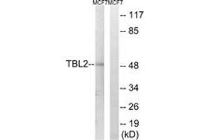 Western blot analysis of extracts from MCF-7 cells, using TBL2 Antibody. (TBL2 antibody  (AA 381-430))