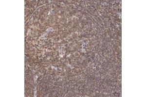 Immunohistochemical staining of human tonsil with HIF1A polyclonal antibody  shows moderate cytoplasmic positivity in reaction center cells and lymphoid cells outside reaction center. (HIF1A antibody)