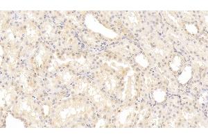 Detection of NOS2 in Human Kidney Tissue using Monoclonal Antibody to Nitric Oxide Synthase 2, Inducible (NOS2) (NOS2 antibody  (AA 533-696))