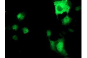 Anti-ATP6V1B1 mouse monoclonal antibody (ABIN2454300) immunofluorescent staining of COS7 cells transiently transfected by pCMV6-ENTRY ATP6V1B1 (RC209462). (ATP6V1B1 antibody)