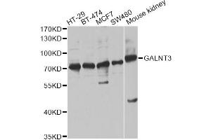 Western blot analysis of extracts of various cell lines, using GALNT3 antibody (ABIN6292787) at 1:1000 dilution. (GALNT3 antibody)