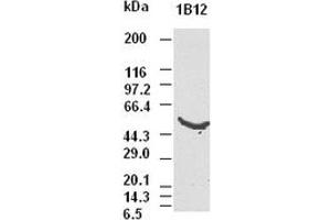 CK8 antibody (1B12) at 1:5000 dilution + Hela cell lysate (KRT8 antibody  (AA 91-381))