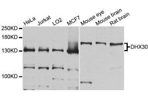 Western blot analysis of extracts of various cell lines, using DHX30 antibody (ABIN5996443) at 1/1000 dilution.