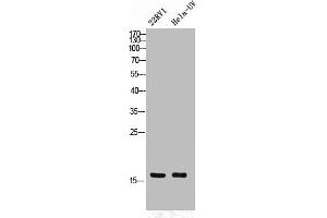 Western Blot analysis of 22RV1 HELA cells using Phospho-p16 (S326) Polyclonal Antibody (CDKN2A antibody  (pSer326))
