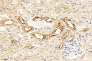 Immunohistochemistry analysis of paraffin-embedded human kidney using,TMEM213 (ABIN7075999) at dilution of 1: 2000 (TMEM213 antibody)
