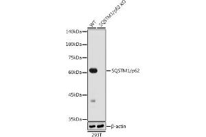 Western blot analysis of extracts from wild type (WT) and SQSTM1/p62 knockout (KO) 293T cells, using SQSTM1/p62 antibody (ABIN7270205) at 1:1000 dilution. (SQSTM1 antibody)